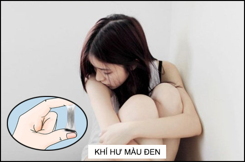 Khí hư có màu nâu đen và hôi