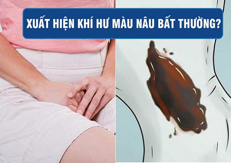 Dịch âm đạo màu nâu dạng bột