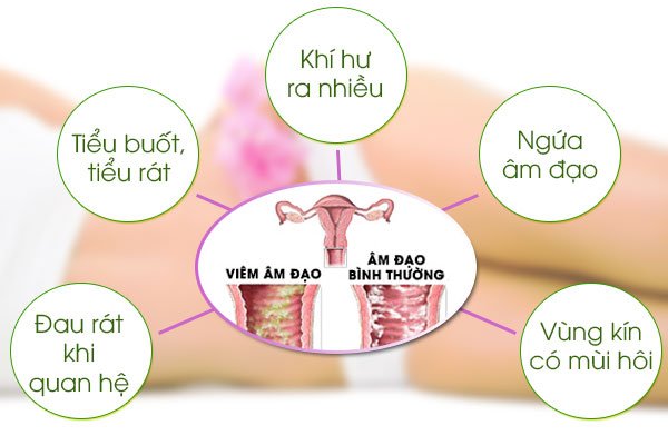 ​Biểu hiện của bệnh phụ khoa