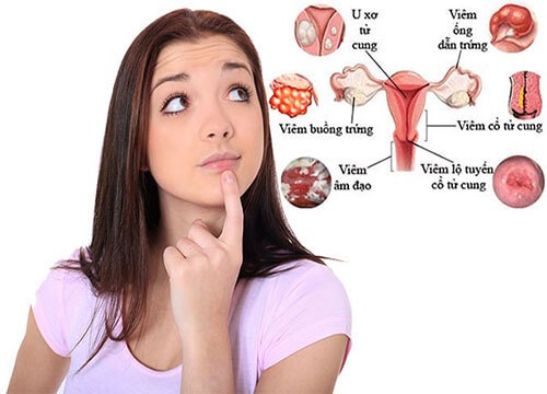 một số vấn đề phụ khoa và cách điều trị